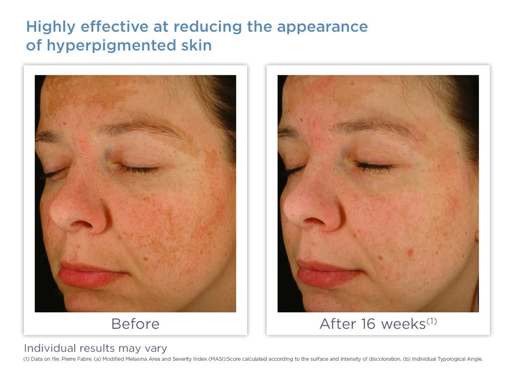 Glytone- Enhanced Brightening Complex