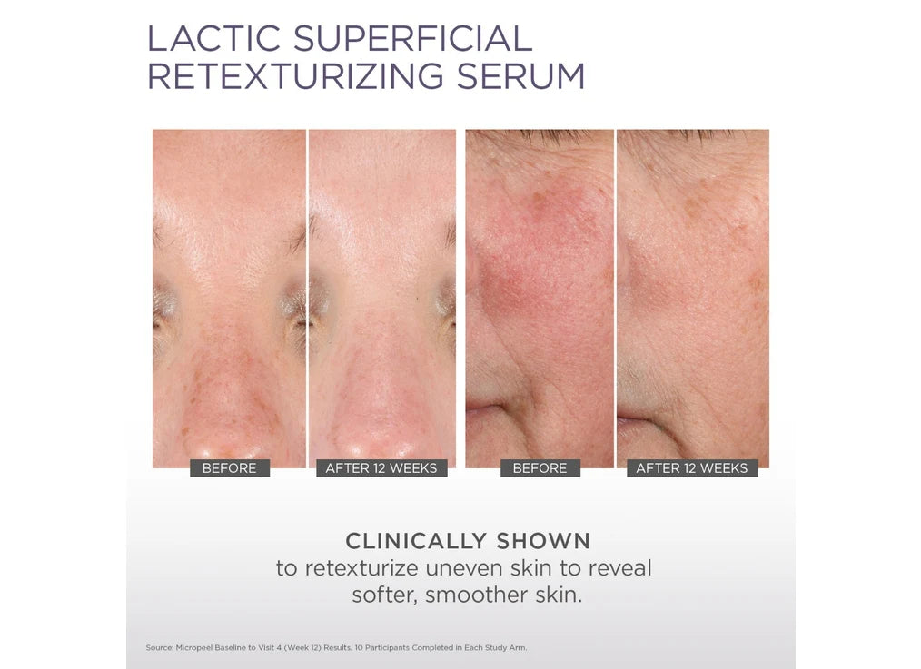 Glytone- Lactic Superficial Retexturizing Serum
