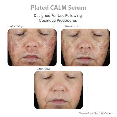 Plated- CALM Serum
