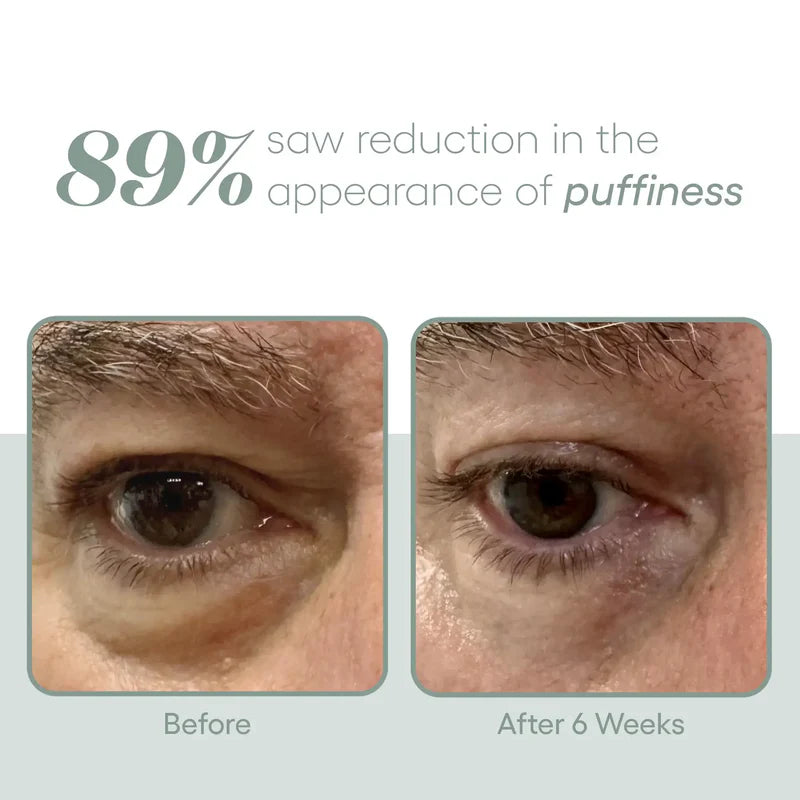 Plated- Eye Serum 8ml