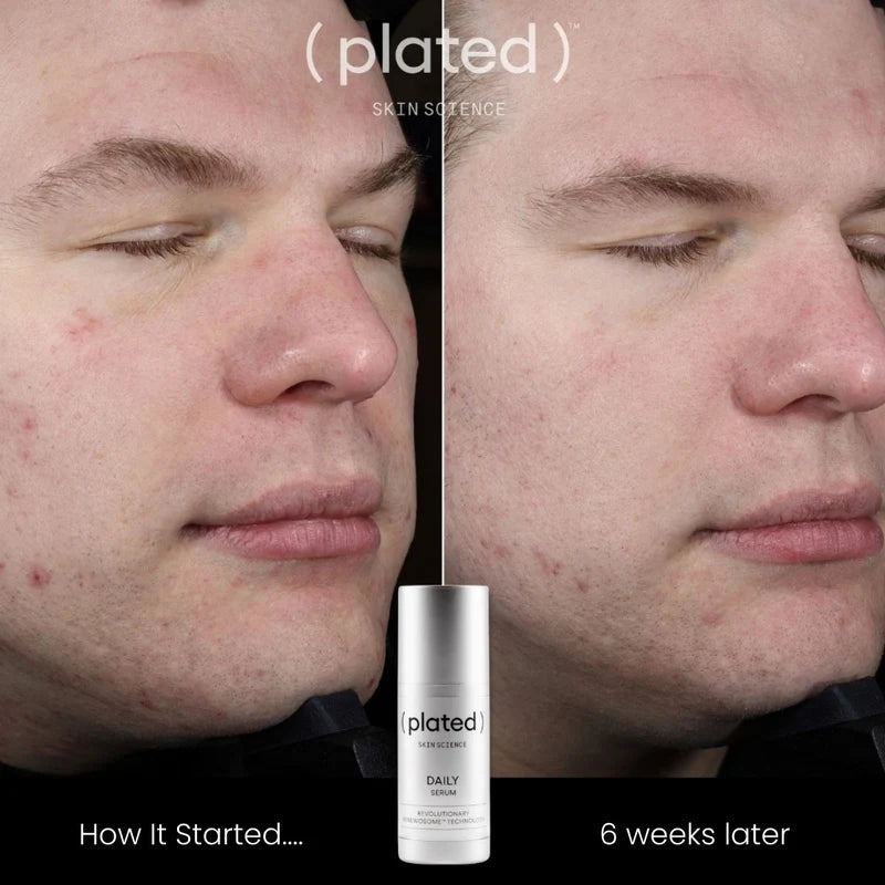 Plated-Daily Serum  30ml