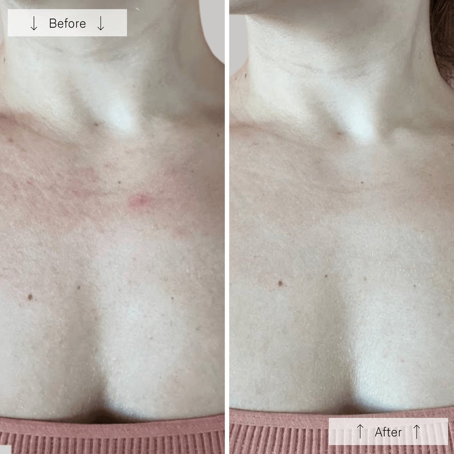 Omnilux Contour Neck and Decollete