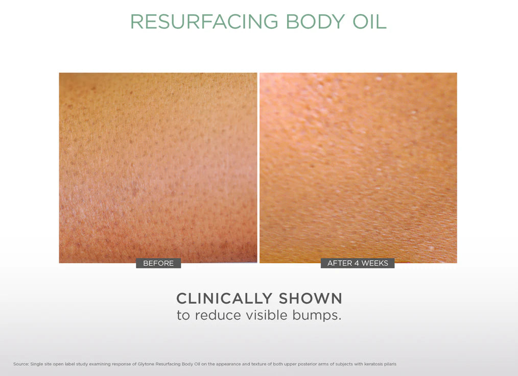 Glytone- Resurfacing Body Oil