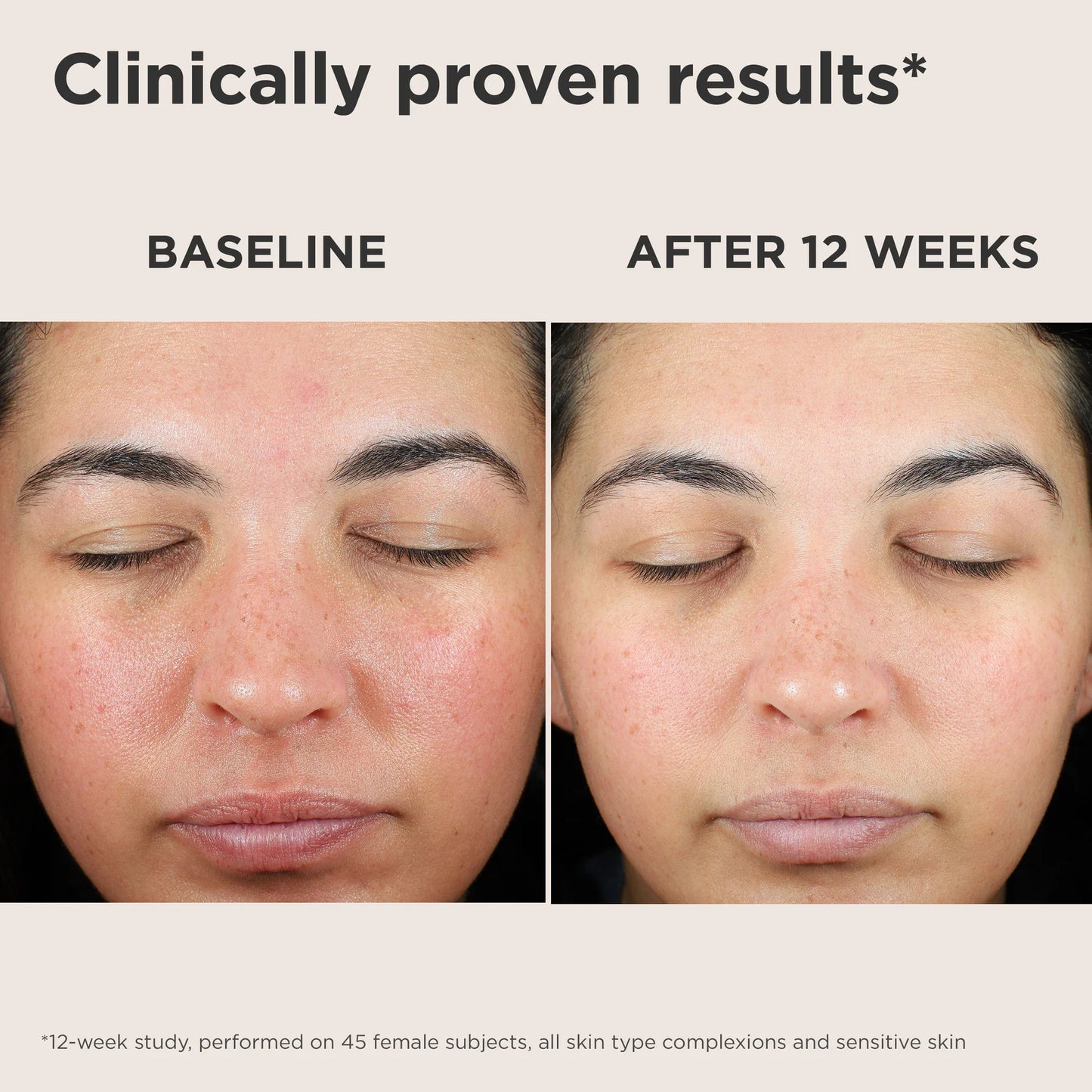 EltaMD- UV SKin Recovery Broad Spectrum SPF 50