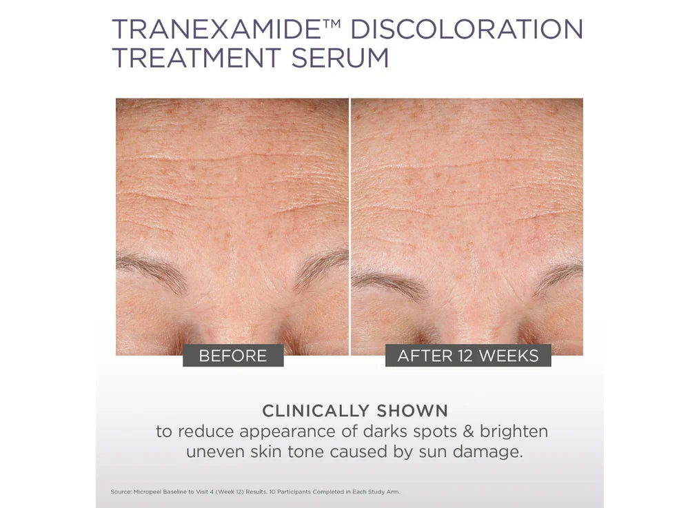 Glytone- TransEXamide Discoloration Treatment Serum